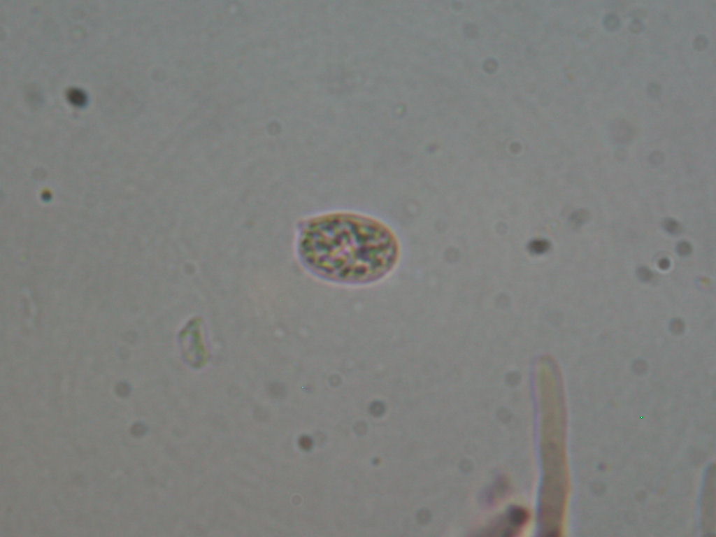 Da determinare...!!! (Radulomyces molaris)